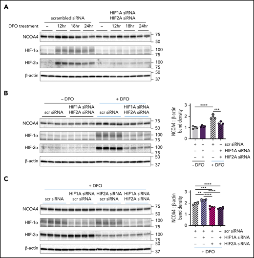 NCOA4 protein induction by DFO is modulated by HIF knockdown. (A) Immunoblotting analyses of NCOA4, HIF-1α, HIF-2α, and β-actin in protein lysates harvested from transfected Hep3B cells either before DFO treatment (−) or after 12, 18, or 24 hours of DFO treatment. For panel A, Hep3B cells, which had been grown in CM supplemented with 50 μM FAC (CM+FAC), were seeded at 2.5 × 105 cells per well in 6-well plates and reverse transfected with either scrambled siRNA alone (10 nM) or with both HIF1A siRNA and HIF2A siRNA (each at 5 nM) in CM+FAC without antibiotics. Twenty-four hours later, the media were replaced with antibiotic-free CM supplemented with 100 μM DFO. Proteins were harvested from each siRNA group at 4 timepoints: immediately before addition of DFO-supplemented CM (0 hr) and at 12, 18, and 24 hours after addition of DFO-supplemented media, as diagramed in supplemental Figure 11. n = 2 per group. (B) Immunoblotting analyses of NCOA4, HIF-1α, HIF-2α, and β-actin in protein lysates harvested from Hep3B cells that were or were not treated with DFO, after transfection with the indicated siRNAs. The mean band density of NCOA4 relative to β-actin from Hep3B cells transfected with scrambled siRNA and not treated with DFO was normalized to 1. (C) Immunoblotting analyses of NCOA4, HIF-1α, HIF-2α, and β-actin in protein lysates harvested from Hep3B cells that were treated with DFO, after transfection with the indicated siRNAs. To facilitate relative comparisons between data in panels B and C, the data in panel C have been normalized by setting the mean NCOA4-to-β-actin band density ratio from the DFO-treated scrambled siRNA group (gray hatched bars in panel C) to its normalized mean value from panel B (gray hatched bars in panel B). For panels B and C, Hep3B cells (grown in CM supplemented with 50 μM FAC) were seeded at 2.5 × 105 cells per well in 6-well plates and reverse transfected with scrambled siRNA, HIF1A siRNA, and/or HIF2A siRNA in the same combinations and concentrations used in Figure 5. Twenty-four hours after transfection, media was replaced with CM without antibiotics supplemented with 100 μM DFO (+DFO) or with CM without antibiotics (−DFO). Proteins were harvested 12 hours after the change in media. n = 4 per group. For both bar graphs, data represent mean ± SD. **P < .01, ***P < .001, and ****P < .0001 by 2-way (panel B) or 1-way ANOVA (panel C) with Tukey’s post hoc test. Numbers on the right indicate the position of molecular weight markers in kiloDaltons.