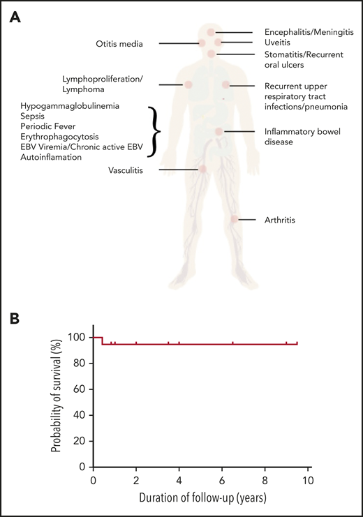 Disease spectrum and transplant outcome in patients with CD27 and CD70 deficiencies. (A) Spectrum of disease manifestation in patients with CD27 and CD70 deficiency. (B) Overall survival post-HSCT for CD27 and CD70 deficiency. The figure has been adapted from Figure 1C in the article by Ghosh et al that begins on page 2638.