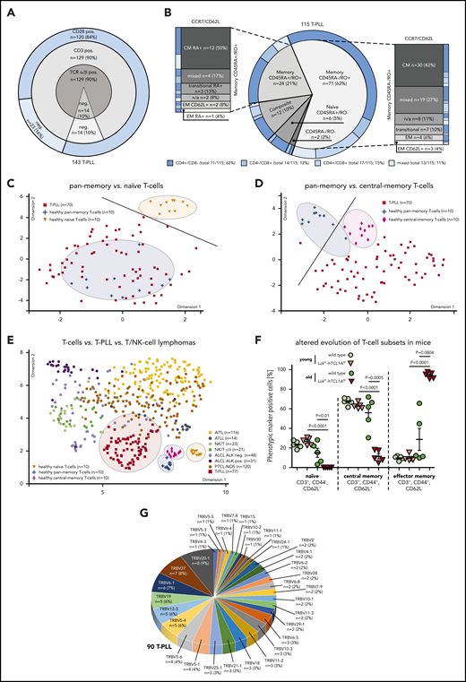 The TCR-positive T-PLL cells comprise a spectrum of memory phenotypes with a predominant CM fraction and frequent unconventional patterns. (A-B) Surface (s) marker expression (flow cytometry) in PB-derived primary T-PLL cells. (A) Distribution of sTCRα/β, sCD3, sCD28 across 143 T-PLL with no case lacking all 3 receptors. (B) Spectrum of naïve/memory differentiation on the basis of expression of CD45RA, CD45RO, CCR7, and CD62L (n = 115; see supplemental Table 2 for marker-defined subsets). A 70% cutoff was used to classify the predominant differentiation. Exemplary cases (including gating strategies) for each conventional and noncanonical pattern are illustrated in supplemental Figure 1A-B. Most cases (95 of 115, 83%) had a dominant T-memory subpopulation (CD45RO+). Within these CD45RA−/RO+ or CD45RA+/RO+ cases, a CCR7+/CD62L+ CM pattern was most frequent. Composite cases comprised 2 distinct populations with at least 1 showing a CD45RO+ phenotype (12 of 115 cases, 10%). Of the few CD45RA+/RO− cases (6 of 115, 5%), 3 (3% of total) resembled classical CCR7+/CD62L+ naïve T cells. A small number of cases had transitional phenotypes of EM-like or of terminally differentiated EM T cells with CD45RA (T-EMRA). Alignments with (co)expression of CD4 and CD8 revealed no association with CD45 isoform patterns. (C-D) Array-based GEP on 70 primary T-PLL and of healthy PB-derived naïve, pan-memory, and CM T cells (10 donors each). UMAP analysis used gene signatures identified in comparative algorithms (25 most differentially expressed genes per comparison; + fold-change sorted; P value cutoff, 0.05; supplemental Methods). The gene lists are in supplemental Table 3, and the most informative genes are illustrated in supplemental Figure 2A. For heatmaps showing signature gene expression in T-PLL vs control samples (unsupervised clustering), see supplemental Figure 2B-C. (C) UMAP on the basis of signature genes identified in the pan-memory vs naive T-cell comparison. Circles and a separator line highlight distinct clustering of healthy-donor T cells vs T-PLL cells. (D) UMAP based on signature genes identified by pan-memory vs CM T-cell comparison. (E) Clustering of 77 T-PLL vs 373 T-cell/natural killer–cell lymphomas using UMAP (5000 most differentially expressed genes over all entities). (F) Accumulation of EM T cells in TCL1A-driven murine (pre)leukemic expansions (flow cytometry). T-splenocytes from young (10 weeks) or old (10 to 16 months) Lckpr-hTCL1Atg mice vs age-matched C57BL/6J wild-type controls (n = 5 each). (G) Frequency-ranked TRBV gene usage in dominant TRB clonotypes of 90 T-PLL on the basis of TRB NGS.
