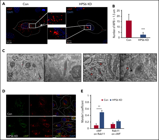 Depletion of BLOC-2 results in rounded, immature WPBs that are trapped in a post-TGN compartment. (A) IF analyses of BLOC-2 component HPS6-depleted and control HUVECs labeled with anti-VWF antibody and counterstained with DAPI. The insets are 4× magnifications of the boxed regions. Rod-shaped, mature WPBs distributed throughout the cell can be observed in control cells, but only round, immature WPBs, clumped perinuclearly, are evident in BLOC-2–depleted cells. Scale bars represent 10 μm. (B) Fifteen BLOC-2–depleted and control cells were randomly selected and total number of WPBs > 1.5 μM in length were determined for 2 independent studies (***P < .001). (C) Transmission EM analyses of BLOC-2–depleted and control HUVECs showing presence of mature, rod-shaped WPBs (*) in control cells with characteristic striated appearance, whereas BLOC-2–depleted cells lacked mature WPBs altogether. Instead, only immature WPBs (block arrows) in the vicinity of the Golgi apparatus (+) were observed. Scale bars represent 500 nm (long bar) and 100 nm (short bars). (D) IF analyses of BLOC-2–depleted and control HUVECs dual-labeled with anti-VWF and Rab11 antibodies and counterstained with DAPI. The inset (magnified 4×) highlights colabeling of VWF and Rab11 in BLOC-2–depleted cells. Scale bars represent 10 μm. (E) Bar graph showing Mander’s overlap coefficient of VWF staining on Rab11 and Rab11 on VWF in Con and BLOC-2–depleted cells. Fifteen BLOC-2–depleted and control cells each from 2 experiments were analyzed (**P < .01).