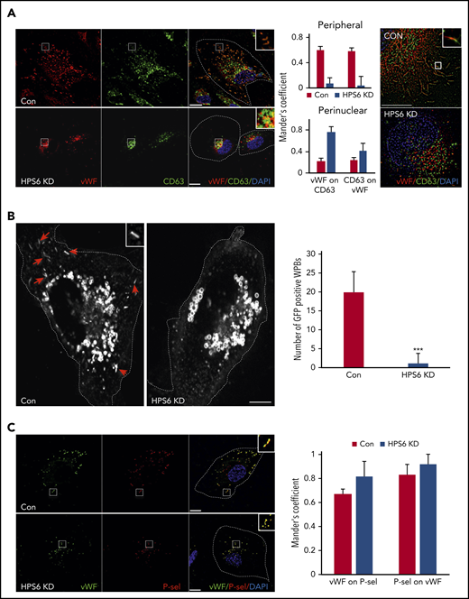 BLOC-2–depleted immature WPBs lack endosomal input. (A) IF analyses of BLOC-2–depleted and control HUVECs dual-labeled with anti-VWF and CD63 antibodies, counterstained with DAPI. The insets highlight colabeling of mature WPBs with CD63 in control cells in contrast to perinuclear localization of the 2 in BLOC-2–depleted cells. Scale bars represent 10 μm. The bar graphs show Mander’s overlap coefficient. Fifteen cells each from 2 experiments were analyzed. The right panel shows super-resolution analysis using radial fluctuation (SRRF) of anti-VWF and anti-CD63 dual-labeled HUVECs confirming separation of VWF and CD63 signals in the perinuclear immature WPBs in BLOC-2–depleted cells compared with colabeled peripheral mature WPBs in control cells. Scale bars represent 2.5 μm. (B) IF analysis of HUVECs transduced with GFP-CD63 expressing lentiviral particles 48 hours after transfection with either control or HPS6 siRNA. Arrows show GFP-labeled mature rod-shaped WPBs in control cells missing in BLOC-2–depleted cells and the inset highlights a mature WPB. GFP labels endosomes in both cell types. Scale bars represent 10 μm. Bar graph compares total number of GFP-labeled mature WPBs per cell in control compared with BLOC-2–depleted cells. Fifteen cells each from 2 experiments were analyzed (***P < .001). (C) IF analyses of BLOC-2–depleted and control HUVECs dual-labeled with anti-P-selectin and CD63 antibodies, counterstained with DAPI. The insets highlight colabeling of VWF and P-selectin in both control and BLOC-2–depleted cells. Scale bars represent 10 μm. The bar graphs show Mander’s overlap coefficient. Fifteen cells each from 2 experiments were analyzed.