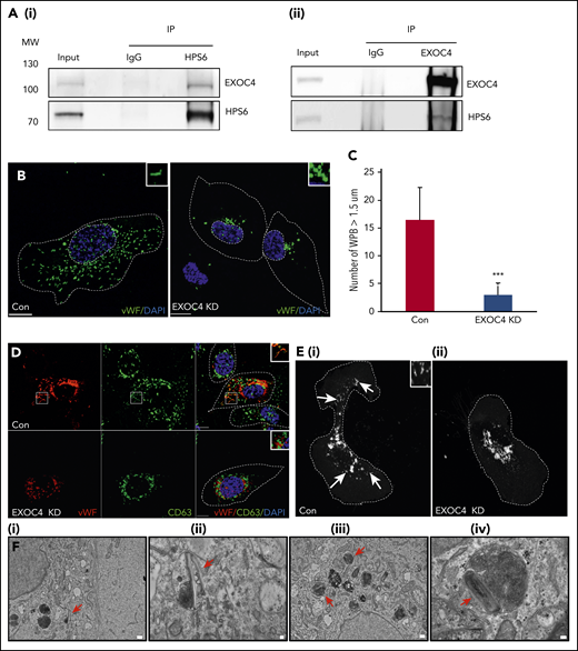 BLOC-2 interacts with the exocyst complex, which is essential for WPB biogenesis. (A) IPs of HUVEC lysates with anti-HPS6 (i) or EXOC4 (ii) antibodies resolved by SDS-PAGE and immunoblotted with HPS6 and EXOC4 antibodies. HUVEC lysate (∼5% of IP) used as input and IP with polyclonal IgG used as a control for both immunoblots. (B) IF analyses of EXOC4-depleted and control HUVECs labeled with anti-VWF antibody and counterstained with DAPI. As for BLOC-2–depleted cells, only rounded, immature WPBs, which are clumped perinuclearly are evident, highlighted by insets. Scale bars represent 10 μm. (C) Fifteen BLOC-2–depleted and control cells were randomly selected and total number of WPBs > 1.5 μM in length were determined for 2 independent studies (***P < .001). (D) EXOC4-depleted and control HUVECs dual labeled with anti-VWF and CD63 antibodies were analyzed by IF, counterstained with DAPI. The insets highlight colabeling of mature WPBs and CD63 in control cells, absent in EXOC4-depleted cells. Scale bars represent 10 μm. (E) GFP-CD63–expressing HUVECs analyzed by IF 48 hours after transfection with control or EXOC4 siRNA. Arrows show GFP-CD63 labeling of mature WPBs in control cells (i), absent in EXOC4-depleted cells (ii). Inset highlights mature WPBs. Scale bars represent 10 μm. (F) EM analyses of EXOC4-depleted HUVECs show immature WPBs with unfurled VWF (arrows). Scale bars represent 500 nm (i and iii) and 100 nm (ii and iv).