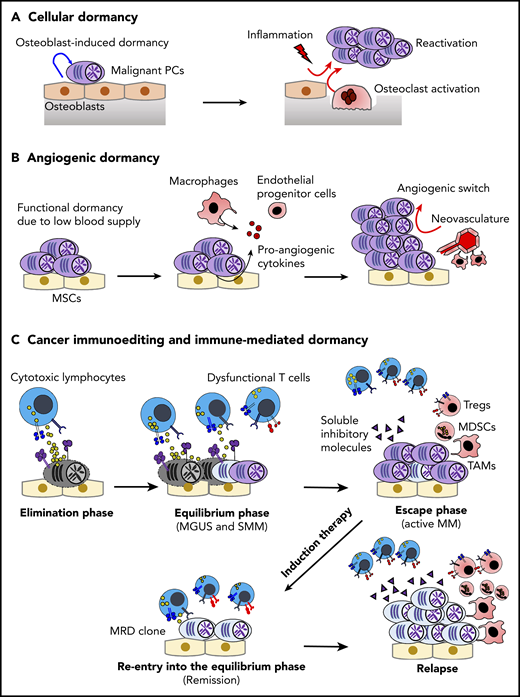 Dormancy and cancer immunoediting in PC dyscrasias. (A) The BM osteoblastic niche induces dormancy in malignant PCs. Note that other immune cells in the PC niche might also contribute to cellular dormancy. Enhanced osteoclast activity and inflammation signaling can abrogate the niche-induced dormancy. (B) Lack of sufficient blood supply renders functional dormancy, called angiogenic dormancy. In addition to the bidirectional interaction between MM cells and MSCs, tumor-associated macrophages (TAMs) contribute to the generation of proangiogenic factors. In response to these stimuli, endothelial progenitor cells and TAMs cooperatively generate neovasculature, which might trigger the growth of MM. (C) Cytotoxic lymphocytes, such as natural killer cells and CD8+ T cells, critically contribute to the immunosurveillance of malignantly transformed cells in the elimination phase. In the equilibrium phase, immune-mediated functional dormancy prevents outgrowth of malignant PCs, which might represent MGUS and SMM. In active MM, malignant PCs eventually overwhelm the immune system, leading to development of the immunosuppressive milieu (the escape phase). Reentry into the equilibrium phase can be achieved by remission-induction therapy, which can contribute to long-term minimal residual disease (MRD) control in some patients. However, the immunosuppressive milieu is reestablished after relapse.