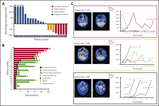 Treatment outcome of avelumab in relapsed or refractory ENKTL. (A) Waterfall plot of 21 patients. (B) Swimmer plot according to treatment duration and survival. (C) Representative images of patients showing complete and partial response and progression and the serial changes of EBV DNA titer in whole blood.