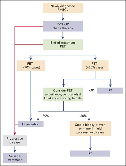 Proposed treatment paradigm for newly diagnosed PMBCL.