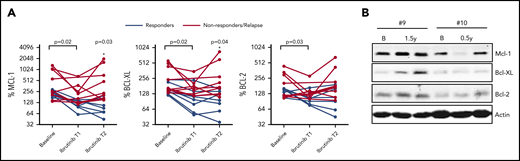 Reappearance of Bcl-2 members upon ibrutinib relapse. (A) Summary of Bcl-2 member expression in LN emigrants before and during ibrutinib treatment (n = 16). Ibrutinib T1 represents an early time point showing clinical response to ibrutinib, and T2 represents a later time point upon ibrutinib treatment. Red lines indicate patients who relapsed on ibrutinib (n = 9), and black lines indicate patients who stayed in remission (n = 7). Geometric mean fluorescence intensities were normalized by setting the baseline LN immigrant population at 100%. The paired-sample Student t test was used for statistical analysis for all patients to compare expression at baseline with expression upon ibrutinib treatment. Subsequently, patients were divided into remission or relapse groups, after which 1-way analysis of variance was used to compare Bcl-2 member expression between groups during follow-up. (B) Western blot of peripheral blood collected from 2 patients who relapsed on ibrutinib. Samples were collected at baseline, after 0.5 to 1.5 years of ibrutinib treatment, and during relapse on ibrutinib after 4 years (patient #9) and 1 year (patient #10) of treatment. Protein lysates were probed for Mcl-1, Bcl-XL, and Bcl-2; actin was used as loading control. B, baseline.