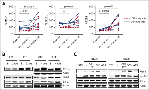Levels of Bcl-2 members increase upon venetoclax treatment. (A) Summary of Bcl-2 member expression in LN emigrants and immigrants before and after venetoclax treatment (n = 5). Venetoclax T1 and T2 represent time points 1 and 2 (ie, the first and second sampling of PB during venetoclax ramp-up; median time of 3 weeks in between time points). A paired-sample Student t test was used for statistical analyses between baseline and Venetoclax T1 or T2. (B) Western blot of PB collected from 4 patients treated with venetoclax. Samples were collected at baseline and upon 2 to 4 weeks of venetoclax treatment. Protein lysates were probed for Mcl-1, Bcl-XL, and Bcl-2; actin was used as loading control. (C) CLL cells of 2 patients were cultured on 3T3 or 3T40L for 24 hours. After detachment, cells were treated with the BH3 mimetics venetoclax (ABT199), S-63845 (S63), or A-1331852 (A13) for an additional 24 hours. Protein lysates were probed for Mcl-1, Bcl-XL, and Bcl-2; actin was used as loading control. B, baseline; ns, not significant.