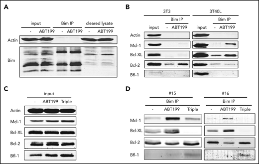 Functional hierarchy of Bcl-2 members in determining resistance to venetoclax. (A-B) CLL cells were cultured on 3T3 or 3T40L for 24 hours. After detachment, cells were treated with 5 µM QVD and 100 nM venetoclax for an additional 24 hours and then lysed with NP-40 lysis buffer. Shown are the protein lysates (input), the proteins in the lysates that were pulled down (Bim IP), and the proteins still present in the lysates after the IP (cleared lysate) (A), as well as the coimmunoprecipitated proteins of the Bim IP (B). (C-D) CLL cells were cultured on 3T40L for 24 hours. After detachment, cells were left untreated (-) or treated with 5 µM QVD and 100 nM venetoclax (ABT199) supplemented or not with 100 nM S-63845 and 300 nM A-1331852 (Triple) for 24 hours before lysis. Shown are the protein lysates (input) (C) and the coimmunoprecipitated proteins of the Bim IP from patients #15 and #16 (D). IP, immunoprecipitation.