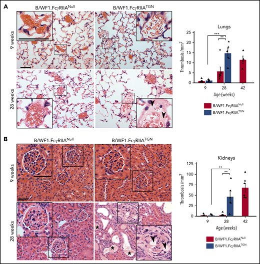 The role of FcγRIIA in organ thrombosis in SLE. Representative images of hematoxylin and eosin staining for lung (A) and kidney (B) sections from B/WF1.FcγRIIATGN or B/WF1.FcγRIIANull mice at 9 and 28 weeks of age. Higher magnifications are presented in insets for each condition (scale bars are identified in upper left microscopic images in A and B and are equivalent to 50 µm). Quantification of lung thrombosis (n = 5 per group) (A) and kidney thrombosis (n = 5 per group) (B) in B/WF1.FcγRIIANull and B/WF1.FcγRIIATGN mice. Arrow heads indicate vascular thrombi, and stars indicate tubule obstruction. Data are presented as the mean ± SEM. Statistical analyses: Šídák’s multiple comparisons test (A-B). Note that in both A and B, a significant difference between 9 and 28 weeks was observed in thrombi counts only in B/WF1.FcγRIIATGN mice. **P < .01, ***P < .001.