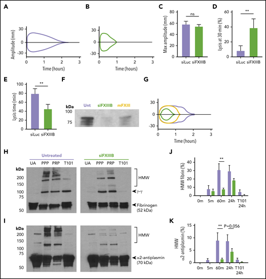 siFXIIIB delays crosslinking of α2-antiplasmin, leading to clots that are more susceptible to lysis ex vivo. (A-B) Representative TEG curve tracings using blood from mice treated with siLuc (A, lavender) or with siFXIIIB (B, green). In each case, recombinant tissue factor was added to stimulate clotting and 4 nM of tPA was added to enhance lysis. (C-E) TEG curves were quantified for (C) maximum clot stiffness, (D) percent of clot lysed after 30 minutes, and (E) time until complete clot lysis; n = 3 mice per treatment group. (F-G) Western blot against FXIII-A and TEG curve tracing of plasma from untreated (Unt) mice (lavender), mice pretreated with siFXIIIB (green), and mice pretreated with siFXIIIB and given an IV dose of mFXIII (yellow). (H-I) Representative western blots against (H) fibrin(ogen) and (I) α2-antiplasmin comparing the HMW species in plasma clotted for 1 hour from untreated mice or those treated with siFXIIIB 2 weeks previously. Clots were formed and lysed in plasma samples with platelets (PRP) or without platelets (PPP) 1 hour after adding CaCl2 to plasma. Non-recalcified plasma was used as a control for unactivated (UA) FXIII, and plasma with an inhibitor of FXIII-A* was added in vitro as a control (T101, 0.8 mM). (J-K) Crosslinking of fibrin and α2-antiplasmin was assessed over time by western blot of PPP clots from untreated mice (lavender) or siFXIIIB pretreated mice (green) and quantified using densitometry. Graphs show the percentage of fibrin or α2-antiplasmin found in the HMW range (100-200 kDa) compared with the total amount of fibrin or α2-antiplasmin. For all graphs, values represent mean ± SEM. **P < .01, and ns indicates not significant.