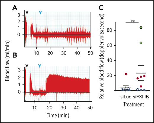 Pretreatment with siFXIIIB renders arterial thrombi more susceptible to lysis in vivo. Doppler ultrasound measured blood flow after thrombi were induced in the carotid artery with a 10% w/v solution of FeCl3, and tenecteplase was administered at a dose of 9 mg/kg. (A-B) Representative Doppler graphs show the time when FeCl3 was applied (black arrow, followed by a 2-minute gap in measurement), occlusion of the vessel, drop in blood flow, injection of tenecteplase (light blue arrow), and then either no recovery of blood flow (A, siLuc treated) or stable reperfusion (B, siFXIIIB treated). (C) Quantification of panels A and B, measuring the blood flow until 60 minutes after occlusion (n = 9). Data markers indicate whether reperfusion was stable (green), transient (red), or if no reperfusion occurred (white). For all graphs, values represent mean ± SEM. ns, P > .05; **P < .01.