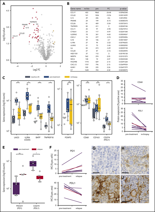 Microenvironmental dynamics during anti-PD1 therapy. (A) Volcano plot showing the most significant changes in gene expression comparing rebiopsies with pretreatment Hodgkin lymphoma (HL) samples, using the NanoString PanCancer Immune Profiling Panel. The fold change of gene expression (FC) is plotted against the P value. Genes highlighted in red have an FC < −2 and a P value < .05, whereas genes highlighted in yellow have an FC > 2 and a P value < .05. The graph also shows the expression changes of a group of known HRSC genes. (B) Most significant differentially expressed genes comparing rebiopsies with pretreatment samples. (C) Analysis of gene-expression changes for a group of genes associated with the Tr1 phenotype (left panel), for FoxP3 as a marker for Tregs (middle panel), and for macrophage genes (right panel) in samples from reactive lymph nodes (LN), HL pretreatment samples, and the relative rebiopsies. *P < .05, **P < .005, Student t test. (D) WSI analysis of CD68 and PD-L1 in HL pretreatment samples and the relative rebiopsies. The difference in CD68 expression was not significant, whereas PD-L1 showed a significant reduction in expression (P = .0276, 2-tailed paired Student t test). Red lines represent the mean values. (E) Analysis of gene-expression changes for PDCD1 (PD1) and CD274 (PD-L1) in paired samples from a r/r cHL cohort with progressive disease/relapse during anti-PD1 therapy. *P < .05, Student t test. (F) Immunohistochemical image analysis of PD1 and PD-L1 in samples from the same cohort as in (E). Increase in PD1+ staining was analyzed by WSI and was not significant (P = .0667, 2-tailed paired Student t test). PD-L1 was analyzed on image sections by manually removing HRSCs in the program before analysis, and measuring of PD-L1 staining was only done on macrophages. The decrease in PD-L1 staining was significant (P = .0184, 2-tailed paired Student t test). Red lines are mean values. Representative images of HRSCs and surrounding TME in r/r cHL samples with progressive disease/relapse during anti-PD1 therapy stained with an anti-PD1 (G-H) or an anti–PD-L1 (I-J) antibody. (G,I) r/r cHL prior to anti-PD1 treatment. (H,J) Relapse during anti-PD1 treatment. Scale bars, 25 µm. ns, not significant.
