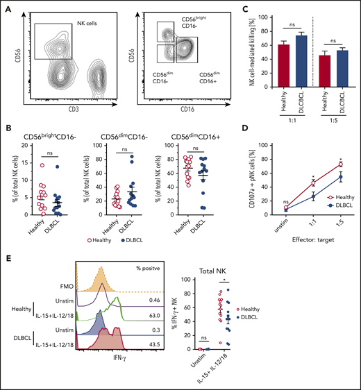 NK cells derived from DLBCL patients produce less IFN-γ. (A-B) Subset composition of NK cells from human peripheral blood monocytes (PBMC) from healthy donors and diffuse large B-cell lymphoma (DLBCL) patients defined by expression of CD56 and CD16. (A) Representative flow cytometric plot showing the gating strategy for NK cells and NK cell subsets. (B) Frequencies of NK cell subsets (n = 13 each group). (C-D) NK cells were flow cytometry-purified from the PBMCs of healthy or DLBCL donors. NK cells were cultured with IL-2 in vitro to obtain sufficient numbers. NK cells were then cocultured with K562 cells for 6 hours at 1:1 or 1:5 effector: target ratios. (C) Frequencies of K562 target cells that were killed after coculture (n = 4-5 each group). (D) Frequencies of NK cells undergoing degranulation (CD107a+). (E) PBMC from healthy donors and DLBCL patients were stimulated with IL-15 + IL-12 + IL-18 for 20 hours or left unstimulated. GolgiPlug was added for the last 4 hours to stop protein release. Frequencies of IFN-γ/granzyme B (GzmB)-producing NK cells were assessed by flow cytometry (n = 13 each group). Data show mean ± SEM; statistical significance (*P < .05; NS, not significant) was determined by (B) Mann-Whitney test or by (C-E) 2-way ANOVA followed by Sidak test.