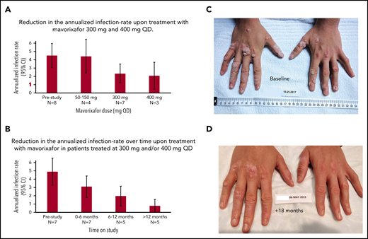 Clinical response to treatment. (A) Reduction in the annualized infection rate upon treatment with mavorixafor, 300 mg and 400 mg once daily. Reduction in the annualized infection rate upon treatment with mavorixafor, 300 mg and 400 mg once daily, compared with the 12 months prior and to lower doses of mavorixafor (50 to 150 mg once daily). The retrospective yearly infection rate in the 12 months prior to the trial was calculated based on the safety population (n = 8). The yearly infection rate is derived from the sum of the number of infection events for each patient divided by the total exposure time (in years). (B) Reduction in the annualized infection rate over time upon treatment with mavorixafor in patients treated at 300 mg and/or 400 mg once daily. Yearly infection rates compared with the 12 months prior to the study. The retrospective yearly infection rate in the 12 months prior to the trial was calculated based on the patients treated up to ≥300 mg (n = 7). The yearly infection rate at each treatment period is derived from the sum of the number of infection events for each patient divided by the exposure time (in years) at each time period. (C-D) Significant reduction in the number of cutaneous warts during long-term once-daily mavorixafor treatment. Patient P6 was treated with increasing doses of mavorixafor alone for a total of 18 months (including 14 months at 400 mg once daily). The patient was not given imiquimod or other treatments for HPV. (C) Warts at baseline. (D) Warts 18 months later, after 14 months at 400 mg. A significant decrease in wart burden could be seen after 6 months on treatment.