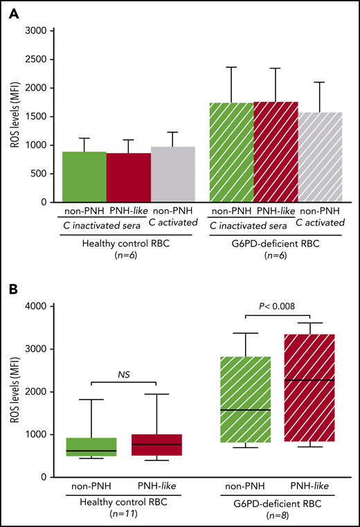 The effect of complement activation on oxidative stress in PNH-like RBCs, in the presence of C5 blockade, depends on their G6PD status. Levels of ROS, expressed as mean fluorescence intensity (MFI), were quantitated by flow cytometry with dichlorodihydrofluorescein diacetate (400 µM),10 after 24 hours at 37°C since complement activation. (A) Bar diagram of ROS levels in non-PNH (green bars) and in PNH-like RBCs (red bars) from 6 healthy control subjects (Healthy control RBC; solid bars) and from 6 G6PD-deficient male subjects (G6PD-deficient RBC; striped bars) after exposure to sera in which complement (C) had been heat-inactivated (C-inactivated sera). The gray bars show ROS levels when non-PNH RBCs were exposed to complement activated by acidification (C activated); as expected, PNH-like RBCs were lysed when exposed to activated complement (data not shown). Average and standard errors are shown. In these experiments, sera were acidified even when complement was due to be heat inactivated to make sure that acidification as such had no effect. (B) Box and whisker plot of levels of ROS after complement activation in the presence of C5 blockade by eculizumab in non-PNH (green boxes) and PNH-like RBCs (red boxes) from 11 healthy control subjects (Healthy control RBC; solid boxes) and from 8 G6PD-deficient male subjects (G6PD-deficient RBC; striped boxes). ROS levels are expressed as MFI, the bottom and top of the box show the 25th and 75th percentile, the horizontal line within the box shows the median, and the ends of the whiskers represent the minimum and the maximum value. Nonparametric tests for paired (Wilcoxon) and unpaired (Mann-Whitney) samples were performed, as appropriate. Statistical significance was accepted for P ≤ .05. NS, not statistically significant.