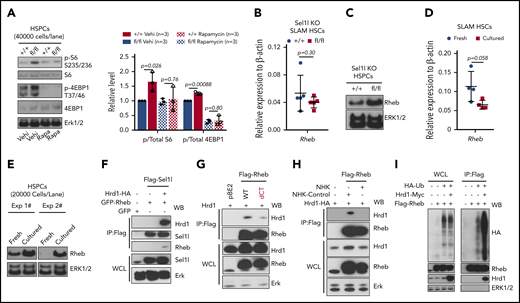 mTOR signaling is activated in Sel1L KO HSCs and Rheb is a novel substrate of Sel1L/Hrd1 ERAD. (A) Representative (left) western blot and (right) summary of quantitation from 3 independent experiments using Mx1-cre+; Sel1Lfl/fl (fl/fl) or control (+/+) mice treated with vehicle or rapamycin. The mice were injected with total 6 doses of pIpC (every 2 days) and injected with rapamycin (4 mg/kg) or vehicle daily (started 6 days before pIpC and continued until the time of analysis). Two weeks after the last dose of pIpC, LSK cells were sorted from the mice for western blot. The levels of mRNA (B, by RT-qPCR; n = 5) and protein level (C, by western blot) of Rheb in HSPCs isolated from Mx1-cre+; Sel1Lfl/fl (fl/fl) or control (+/+) mice were analyzed 2 weeks after pIpC injection. (D-E) The mRNA and protein levels of Rheb in HSCs freshly isolated or cultured in SF-03 media for 24 hours. (F-H) HEK 293T cells were transfected with constructs that overexpress tagged Sel1L, Hrd1, Rheb, or NHK proteins (indicated on top of each blot), and the protein interaction was analyzed by coimmunoprecipitation followed by western blot with antibodies labeled on the right of each blot. (I) HEK 293T cells were transfected with constructs that overexpress HA-tagged ubiquitin, FLAG-tagged Rheb, and Myc-tagged Hrd1, and Rheb proteins were immunoprecipitated by Flag antibody and ubiquitinated Rheb proteins were detected by western blot with HA antibody. At least 3 independent experiments of coimmunoprecipitation or western blots were performed with similar results for each assay. For bar graphs, data represent mean ± SD. The number of replicates (n) indicates independent experiments. Two-sided Student t test was used for statistical analysis.