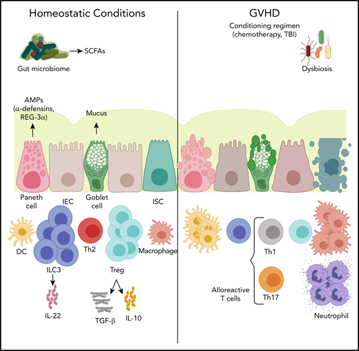 The cross talk of the microbiome and the intestinal immune system in acute GVHD. Under physiologic conditions, the intestinal epithelial cell (IEC) surface maintains an intact barrier that prevents bacterial translocation into host tissue. In addition, Paneth cells produce antimicrobial proteins (AMPs), such as α-defensins and regenerating islet-derived 3α (REG-3α), that further protect against pathogenic organisms and provide trophic signals to intestinal stem cells (ISC). Goblet cells secrete mucus that solidifies the barrier separating the microbiota and host tissues. In allo-SCT, a conditioning regimen often consisting of chemotherapy, with or without total body irradiation (TBI), interrupts the integrity of the intestinal barrier bacterial translocation into host tissue. This leads to neutrophil infiltration into the small intestine producing reactive oxygen species that further contribute to the barrier damage. Bacterial translocation also leads to monocyte activation that mediates T helper 17 cell (Th17) differentiation, which, in turn, leads to macrophage and neutrophil accumulation into the inflammatory sites, as well as dendritic cell (DC) activation that leads to alloreactive cytotoxic T-cell homing. Microbiota-derived short-chain fatty acids (SCFAs) serve as an energy source for IECs and play a protective role in GVHD by inducing regulatory T cells (Treg) that secrete the anti-inflammatory cytokines transforming growth factor-β (TGF-β) and interleukin-10 (IL-10), as well as group 3 innate lymphoid cells (ILC3) that secrete interleukin-22 (IL-22) and, again, mediate anti-inflammatory effects. Th1, T helper 1 cell; Th2, T helper 2 cell.