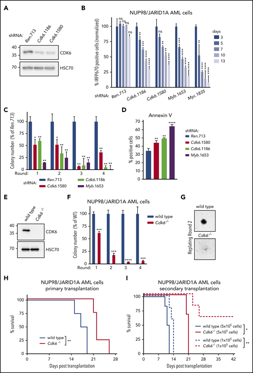 NUP98-fusion–protein-driven leukemia is dependent on CDK6 expression. (A) Western blot analysis of CDK6 levels in NUP98/JARID1A-expressing AML cells after 4 days of Dox-mediated Cdk6 shRNA induction. (B) Results of the competitive proliferation assay shown as the percentage of IRFP670-positive murine NUP98/JARID1A-driven leukemia cells expressing indicated shRNAs in the presence of Dox (0.5 µg/mL) over 13 days (mean ± SD; n = 3). The nontargeting shRNA (shRen.713) is used as neutral control, shRNAs targeting essential genes in hematopoietic cells Myb (shMyb.1653), or Myc (shMyc.1835) as positive controls. (C) Colony formation assay of G418-selected murine NUP98/JARID1A-driven leukemia cells expressing indicated shRNAs in the presence of Dox (0.5 µg/mL) over 4 rounds of replating. Colony numbers were normalized to cells expressing shRen.713 (mean ± SD; n = 3). (D) Quantification of AnnexinV-positive cells of murine NUP98/JARID1A-driven leukemia cells expressing indicated shRNAs after 2 rounds of replating (mean ± SD; n = 3). (E) Western blot analysis of CDK6 levels in wild-type vs Cdk6−/− fetal liver cells. (F) Colony formation assay of bone marrow–derived leukemia cells of mice transplanted with NUP98/NSD1-transformed Cdk6−/− or wild-type fetal liver cells. Colony numbers were normalized to wild-type NUP98/NSD1 leukemia cells (mean ± SD; n = 3). (G) Representative image of colonies from wild-type or Cdk6−/− NUP98/NSD1 leukemia cells, ×40 original magnification. (H) Kaplan-Meier survival curves with statistical analysis using the log-rank test of mice transplanted with wild-type vs Cdk6−/− fetal liver cells transformed with NUP98/NSD1 (n = 4). (I) Kaplan-Meier survival curves with statistical analyses using log-rank tests of secondary transplantations of bone marrow–derived wild-type or Cdk6−/− leukemia cells at indicated concentrations into sublethally irradiated (4.5 Gy) recipient mice (5 × 105 transplanted cells: n ≥ 3, 1 × 105 transplanted cells: n = 5). *P < .05, **P < .01, ***P < .001, ****P < .0001.