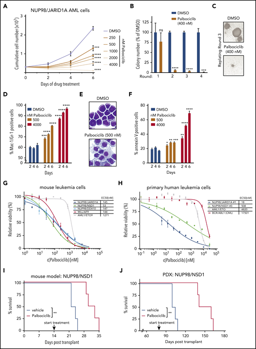 NUP98-fusion–protein-driven leukemia is highly sensitive to pharmacological CDK4/CDK6 inhibition. (A) Proliferation curves of murine NUP98/JARID1A-expressing leukemia cells in the presence of indicated concentrations of Palbociclib (mean ± SD; n = 3). (B) Colony formation assay of murine NUP98/JARID1A-expressing leukemia cells in the presence of dimethyl sulfoxide (DMSO) or Palbociclib. Colony numbers were normalized to DMSO (mean ± SD; n = 3). (C) Representative image of colonies in the presence of DMSO or Palbociclib after 3 rounds of replating, ×40 original magnification. (D) Flow cytometric analyses of Mac-1/Gr-1 surface marker expression in NUP98/JARID1A-expressing AML cells treated with indicated concentrations of Palbociclib (mean ± SD; n = 3). (E) Representative Cytospin images illustrating the morphology of NUP98/JARID1A-expressing AML cells 7 days after DMSO or Palbociclib treatment, ×400 original magnification. (F) Flow cytometric analyses of AnnexinV expression in NUP98/JARID1A-expressing leukemia cells treated with indicated concentrations of Palbociclib (mean ± SD; n = 3). (G-H) Dose-response curves of Palbociclib-mediated growth inhibition of murine leukemia cells (G) and primary patient cells (H) driven by different fusion proteins (mean ± standard error of the mean; n = 3). (I) Kaplan-Meier survival curves with statistical analysis using the log-rank test of C57BL/6 Ly5.1 recipients transplanted with murine NUP98/NSD1-driven leukemia cells after vehicle or Palbociclib treatment (50 mg/kg; n = 4). (J) Kaplan-Meier survival curves with statistical analysis using the log-rank test of NSG mice transplanted with NUP98/NSD1-PDX AML cells after vehicle or Palbociclib treatment (50 mg/kg; n = 4). *P < .05, **P < .01, ***P < .001, ****P < .0001.
