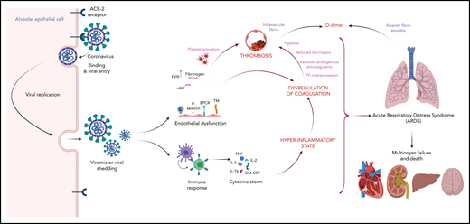 Potential mechanism linking dysregulated inflammation and coagulation with thrombosis. SARS-CoV-2 infects respiratory epithelial cells by binding to the angiotensin-converting enzyme 2 (ACE-2) receptor. Shed virus elicits an inflammatory response, which can be maladaptive in some cases leading to a cytokine storm mediated by proinflammatory cytokines such as interleukin 1β (IL-1β), IL-2, IL-6, tumor necrosis factor (TNF), and granulocyte-macrophage colony-stimulating factor (GM-CSF). Proinflammatory cytokines and SARS-CoV-2 infection of the endothelium contribute to hypercoagulability by upregulation of procoagulants such as tissue factor (TF), P-selectin, factor VIII (FVIII), fibrinogen, and von Willebrand factor (vWF); downregulation of anticoagulants such as thrombomodulin (TM) and endothelial protein C receptor (EPCR); and modulation of fibrinolysis by increased expression of type 1 plasminogen activator inhibitor, and leukocyte recruitment. Finally, the hypoxia and immobility in hospitalized patients with COVID-19 are potent triggers of thrombosis. Illustration created with BioRender.com.