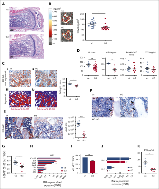 Impaired bone formation and BM stromal niche in th3 mice. (A) Histological analysis of representative BM sections stained with hematoxylin and eosin. Metaphyses from WT and th3 bones are depicted. WT, n = 10; th3, n = 10. Original magnification ×40. (B) Representative sections of the proximal metaphysis of the tibiae, analyzed by pQCT in WT and th3 mice. Trabecular BMD values of mice tibiae. WT, n = 16; th3, n = 16. (C) IHC evaluation of collagen-1 deposition in subchondral trabecular bone area of th3 and control mice. (i-ii) Original magnification ×200, inset ×40; (iii-iv) original magnification ×200. Representative quantitative analysis of collagen-1–stained area by software analysis calculating the IHC-positive area as a percentage of the total nuclear area. WT, n = 4; th3, n = 4. IHC on BM sections by staining with anti-mouse Collagen-I antibody was performed. (D) Evaluation of soluble markers of bone turnover in WT and th3 sera and BM extracellular fluid by enzyme-linked immunosorbent assay. WT, n ≥ 4; th3, n ≥ 6. (E) IHC analysis of JAG1 in BM stromal niche of th3 and control mice (left). Original magnification ×400. Representative quantitative analysis of the JAG1-stained area, calculated with image-analysis software (right). WT, n = 6; th3 n = 6. IHC on BM sections by staining with anti-mouse JAG1 antibody was performed. (F) IHC staining of JAG1 in BM sections of th3 and control mice, highlighting the difference in staining of the endosteal compartment (arrows). Original magnification ×400. (G) Frequencies of ex vivo isolated MSCs expressing the CD73 and Sca-1 markers in WT and th3 BM. Data are represented as the percentage of the Lin−CD45−CD31−CD105− population. WT, n = 10; th3, n = 10. (H) RNA-seq normalized expression of Cxcl12, Scf, and Notch ligands in MSCs from WT and th3 mice. WT, n = 3 pools; th3, n = 3 pools. (I) Median fluorescence intensity (MFI) of NICD+ HSCs in WT and th3 mice. WT, n = 9; th3, n = 8. (J) RNA-seq normalized expression of Hes1 and Hey1 Notch target genes in sorted HSCs from WT and th3 mice. WT, n = 3 pools; th3, n = 3 pools. (K) Evaluation of PTH in WT and th3 sera by enzyme-linked immunosorbent assay. WT, n = 6; th3, n = 7. *P < .05; **P < .01; ***P < .001; ****P < .0001. FPKM, fragments per kilobase million.