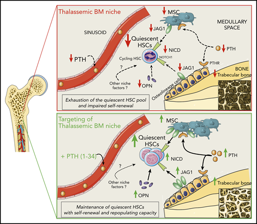 Working model of regulation of HSCs by the BM niche in β-thalassemia and rescue by PTH administration. In β-thalassemia, the lower levels of PTH negatively act via PTH receptors on osteolineage cells and MSCs, resulting in reduced trabecular bone and fewer MSCs. Thalassemic BM stromal cells show lower expression of the Notch-ligand JAG1, which is consistent with the reduced activation of the Notch pathway (activated NICD) in HSCs. Moreover, decreased OPN levels correlate with the increased cycling activity of HSCs, thus affecting their self-renewal capacity and causing the progressive exhaustion of the quiescent HSC pool. In vivo administration of PTH restores thalassemic trabecular bone and MSC frequency, enhancing JAG1 and OPN expression by the BM niche and thus rescuing HSC function.
