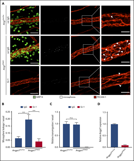 Platelet-derived Angpt1 prevents neutrophil-induced plasma leakage. (A-C) Angpt1lox/lox and Angpt1PltKO mice were injected intraperitoneally with anti–Gr-1 or control IgG antibodies to deplete neutrophils and were stimulated intrascrotally 24 hours later with IL-1β. Four hours later, fluorescent microspheres were injected IV, and cremaster whole mounts were prepared and stained for PECAM-1 and MRP14 5 minutes later. Arrowheads indicate microsphere leakage. Scale bars, 40 µm (left panels), 15 µm (right panels). Microsphere leakage (B) and transmigrated neutrophils (C) per vessel were quantified. (D) Lysates of platelets isolated from Angpt1lox/lox or Angpt1PltKO mice were submitted to an Angpt1 enzyme-linked immunosorbent assay (Bosterbio), according to the manufacturer’s instructions, to measure Angpt1 content. Results are representative of 5 (A) or are pooled from 3 (D) or 5 (B-C) independent experiments, with 50 vessels analyzed. Data are mean ± SEM. ***P < .001, 1-way ANOVA. n.s., not significant.