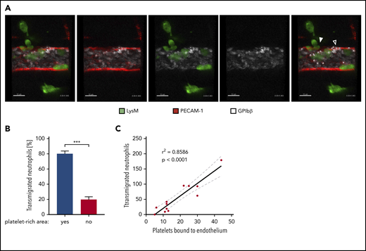 Preferential extravasation of neutrophils in platelet-rich areas of cremasteric venules. (A) Confocal intravital microscopy of cremasteric venules in LysM-eGFP mice that were injected intrascrotally with IL-1β. Endothelial cells and platelets were labeled through IV injection of fluorophore-coupled anti–PECAM-1 and anti–GPIbβ antibodies, respectively. Mice were anaesthetized, the cremaster muscle was prepared for intravital imaging, and videos were taken for 1 to 1.5 hours. White dots mark platelets bound to the endothelium, the filled arrowhead marks areas of neutrophil extravasation, and the open arrowhead marks areas of extravasation (supplemental Video 1). Scale bars, 10 µm. The timestamp of the video is 0:20:41:943. (B) Quantification of neutrophil transmigration in platelet-rich and platelet-poor areas of cremasteric venules from 10 videos shown as the percentage of total transmigrated neutrophils. Data are mean ± SEM. (C) Correlation analysis (Pearson) and linear regression of transmigrated neutrophils and endothelium-bound platelets in videos, as described in (A). Results are representative of (A) or pooled from (B-C) 10 videos taken of 9 mice. ***P < .001, Mann-Whitney rank test.