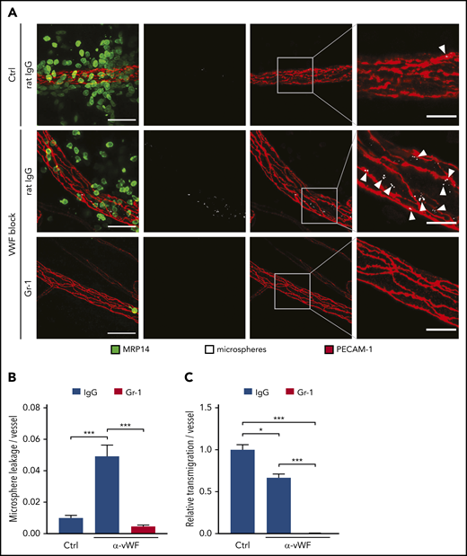 Blockade of endothelial VWF prevents microsphere leakage during neutrophil transmigration. (A) C57BL/6 mice received anti–Gr-1 antibodies or control (Ctrl) IgG and were injected IV with VWF-blocking or control antibodies 24 hours later. Five minutes later, local inflammation was induced by intrascrotal IL-1β injection. Fluorescent microspheres were injected IV 4 hours later, and cremaster whole mounts were prepared and stained for PECAM-1 and MRP14 5 minutes later. Arrowheads indicate microsphere leakage. Scale bars, 40 µm (left panels), 15 µm (right panels). Microsphere leakage (B) and neutrophil extravasation (C) in experiments as depicted in (A) were quantified and normalized to vessel surface. Results are representative of (A) or pooled from (B-C) 5 independent experiments, with 50 vessels analyzed. Data are mean ± SEM. *P < .05, ***P < .001, 1-way ANOVA.