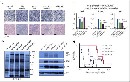 Restoration of miR-185 expression reduces the burden of leukemia and sensitizes leukemic blast cells to TKI treatment, with enhanced survival of leukemic mice. (A) Schematic of the experimental design. BV173YFP/Luc cells transduced with a miR-185-expressing vector, or a pRRL control vector, were injected intravenously into sublethally irradiated nonobese diabetic/severe combined immunodeficiency IL2Rγ-chain–deficient (NSG) mice (2.5 × 106 cells per mouse). Two weeks later, a daily oral gavage treatment of 15 mg/kg DA or vehicle (propylene glycol) was initiated for another 2 weeks. (B) Bioluminescence images of mice taken 2 weeks posttransplantation, before initiation of the oral gavage treatment. (C) Representative bioluminescence images of mice from each group taken 7 weeks posttransplantation. One mouse from each group was then sacrificed to obtain images and weights of spleens and livers. (D) FACS profiles showing human leukemic cell chimerism (GFP+ and YFP+) in PB, BM, spleen, and liver from mice in each group. (E) Representative hematoxylin and eosin-stained sections of spleens and livers from all treatment groups. (F) Fold-difference in BCR-ABL1 transcripts in hematopoietic tissues from each group. Data shown are mean ± SEM of measurements from 3 technical replicates. P values were calculated using a 2-tailed paired Student t test. (G) Western blots of whole protein extracted from BM cells of mice in each group, after probing with the antibodies indicated. (H) Overall survival of mice from each treatment group (n = 6 mice per group). P values were calculated using log-rank test. ND = not detectable.