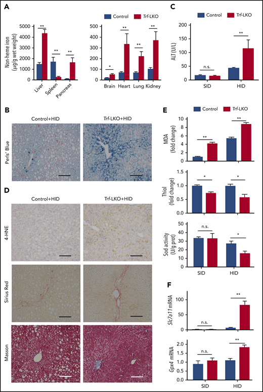 Loss of hepatic Trf exacerbates liver damage induced by an HID. (A) Non-heme iron was measured in the indicated tissues of control and Trf-LKO mice (n = 4 mice/group) after 8 weeks on an HID. (B) Perls Prussian blue staining of liver sections obtained from HID-fed control and Trf-LKO mice; the scale bars represent 100 μm. (C) Serum ALT levels were measured in control and Trf-LKO mice fed either an SID or an HID (n = 4 mice/group). (D) 4-HNE, Sirius Red, and Masson’s trichrome staining were performed on liver sections obtained from HID-fed control and Trf-LKO mice; the scale bars represent 100 μm. Hepatic MDA, thiol, and SOD activity (E) and hepatic Slc7a11 and Gpx4 mRNA (F) were measured in SID-fed and HID-fed control mice and Trf-LKO mice (n = 4 mice/group). *P < .05, **P < .01, Student t test. n.s., not significant.