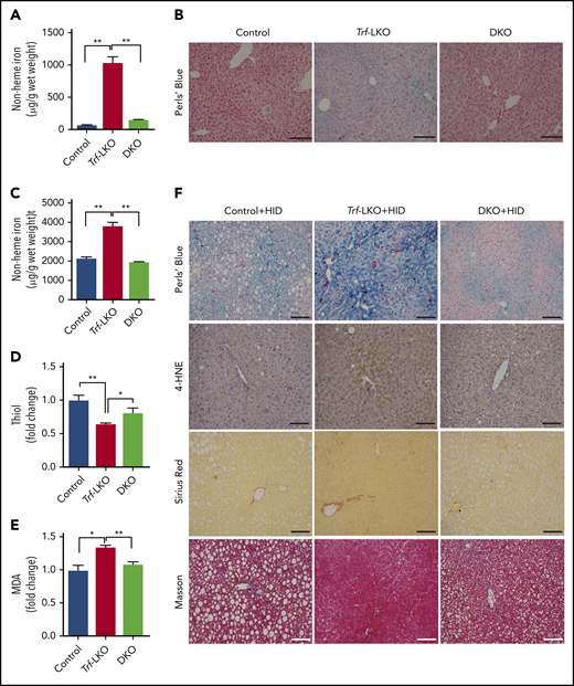 Loss of hepatic Slc39a14 protects against ferroptosis in Trf-LKO mice. (A) Hepatic non-heme iron was measured in control (Trffl/fl), Trf-LKO, and Trf/Slc39a14 double-knockout (DKO) mice fed an SID (n = 4 mice/group). (B) Representative images of Perls Prussian blue‒stained liver sections obtained from SID-fed control, Trf-LKO, and DKO mice; the scale bars represent 100 μm. Hepatic non-heme iron (C), thiol (D), and MDA (E) levels were measured in HID-fed control, Trf-LKO, and DKO mice (n = 4 mice/group). (F) Representative images of liver sections obtained from HID-fed control, Trf-LKO, and DKO mice and stained with Perls Prussian blue, 4-HNE, Sirius Red, and Masson’s trichrome; the scale bars represent 100 μm. *P < .05 and **P < .01, one-way analysis of variance with Tukey’s post hoc test.