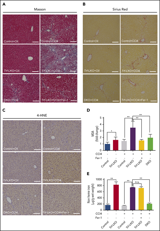 Both inhibiting ferroptosis and deleting hepatic Slc39a14 alleviates CCl4-induced fibrosis in Trf-LKO mice. Control, Trf-LKO, and DKO mice were treated with vehicle (oil) or CCl4, and liver sections were obtained and stained with Masson’s trichrome (A), Sirius Red (B), or 4-HNE (C); the scale bars represent 100 μm. Hepatic MDA (D) and non-heme iron (E) were measured in the indicated mice (n = 4-5 mice/group). *P < .05, **P < .01, one-way analysis of variance with Tukey’s post hoc test. n.s., not significant.