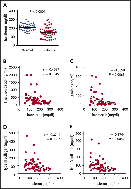 Patients with liver cirrhosis have reduced serum Trf levels. (A) Trf was measured in serum samples obtained from 48 patients with cirrhosis and 52 healthy control subjects. (B-E) The indicated indices of liver fibrosis were measured in the serum of 48 patients with liver cirrhosis and are plotted against serum Trf concentration. The data in panel A were analyzed by using a Student t test; the data in panels B-E were analyzed by using Pearson’s correlation coefficient (r).