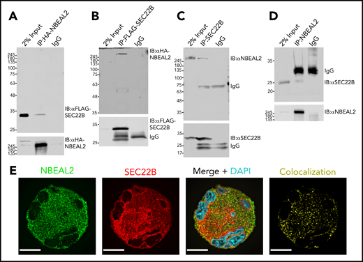 Interaction of tagged NBEAL2 and SEC22B in HEK293 cells, and native proteins in MKs. (A) HA-tagged protein was immunoprecipitated from lysates of HEK293 cells expressing both HA-tagged NBEAL2 (HA-NBEAL2) and FLAG-tagged SEC22B (FLAG-SEC22B). Immunoblots of lysate (input) and immunoprecipitates probed with anti-FLAG and anti-HA antibodies show HA-NBEAL2 pulled down FLAG-SEC22B. (B) IP of FLAG-tagged protein showed that FLAG-SEC22B pulled down HA-NBEAL2. (C) Lysate from primary human MKs was immunoprecipitated with anti-SEC22B antibody; immunoblot analysis shows that endogenously expressed SEC22B pulled down native NBEAL2. (D) IP of NBEAL2 from primary human MK lysate showed that NBEAL2 pulled down SEC22B. (E) Fixed primary human MKs immunostained for NBEAL2 (green) and SEC22B (red) were imaged via laser fluorescence confocal microscopy. XY profiles of midcell z sections from a representative mature cell show substantial overlap of NBEAL2 and SEC22B (bars = 10 μm). Images were obtained with an oil immersion objective (60×/1.35 NA) using a Quorum spinning disc confocal inverted fluorescence microscope. DAPI, 4′,6-diamidino-2-phenylindole; IgG, immunoglobulin G.