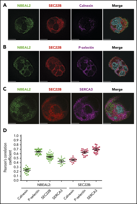 NBEAL2, SEC22B, and membrane-associated proteins in human MKs. Primary human MKs stained for NBEAL2 (green), SEC22B (red), and 1 of the following: calnexin (synthetic ER; magenta) (A), P-selectin (α-granules/precursors; magenta) (B), or SERCA3 (cortical ER; magenta; bars = 10 μm) (C). (D) Colocalization analysis based on Pearson’s correlation coefficient for NBEAL2-calnexin (n = 21 cells), NBEAL2–P-selectin (n = 21 cells), NBEAL2-SEC22B (n = 62 cells), NBEAL2-SERCA3 (n = 21 cells), SEC22B-calnexin (n = 21 cells), SEC22B–P-selectin (n = 21 cells), and SEC22B-SERCA3 (n = 20 cells; bars = 95% confidence intervals) indicates strong overlap among NBEAL2, SEC22B and P-selectin, with NBEAL2 having a weak association with calnexin. Images obtained as described in Figure 1. Colocalization channel images are shown in supplemental Figure 1.