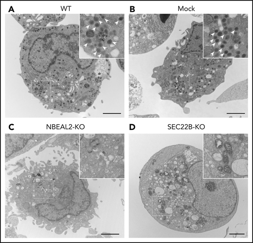 NBEAL2 and SEC22B are required for α-granule formation in imMKCL cells. Transmission electron micrographs of representative cells show abundant electron-dense α-granules (arrow heads in magnified insets) visible in WT (A) and empty lentiviral transduced (mock) (B) cells. Additional imMKCL cells are shown in supplemental Figure 4. α-granules were not observed in NBEAL2-KO (C) or SEC22B-KO (D) cells, indicating both proteins are required for granule formation (bars = 2 μm). Thin sections were cut and stained with uranyl acetate and lead citrate, and samples were examined with a JEOL JEM-1011 electron microscope at 80 kV. Images were captured with a side-mounted Advantage HR CCD camera.