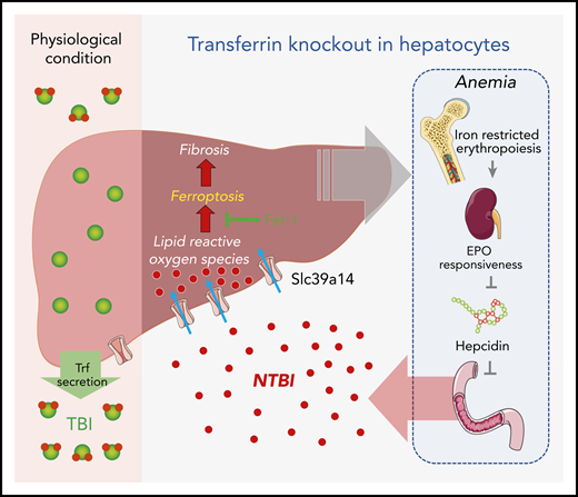 Under physiological conditions, Trf binds to ferric ion and delivers it to a variety of tissues (eg, the liver) for iron requisition and use. When hepatic Trf is absent, affected individuals develop microcytic anemia because of iron-restricted erythropoiesis, which leads to increased iron absorption in the intestine as a consequence of erythropoietin/erythroferrone-dependent suppression of hepcidin, NTBI accumulation via Slc39a14 in multiple organs, and finally the iron overload–evoked ferroptosis, fibrosis, and cirrhosis. EPO, erythropoietin.