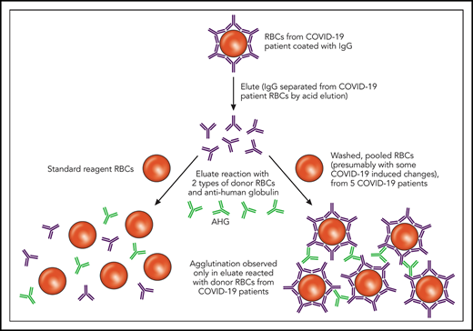Elution studies are performed to separate bound Ig from a patient’s RBCs in the setting of an IgG-positive DAT; this separation is typically accomplished using pH or temperature changes. As depicted, the eluates from COVID-19 patients with an IgG-positive DAT did not show agglutination after incubation with commercially available reagent RBCs. However, the same eluates incubated with RBCs derived from other COVID-19 patients showed agglutination. Professional illustration by Patrick Lane, ScEYEnce Studios. AHG, anti-human globulin.