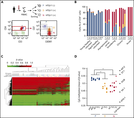 Global DNA hypomethylation occurs in cells infected with HTLV-1. (A) Representative flow cytometric analysis of PBMCs isolated from a patient with chronic ATL. P, CADM1−/CD7+ (blue); D, CADM1+/CD7dim+ (yellow); N, CADM1+/CD7− (red). (B) Proportion of each cell subpopulation (P, D, and N) in the CADM1 vs CD7 plots of healthy volunteers, asymptomatic carriers, and patients with smoldering, chronic, and acute ATL. (C) Unsupervised hierarchical clustering analysis of DNA methylation profiles of 20 000 CpG probes chosen at random from 470 870 probes, which were CpG sites on autosomes and not on the sex chromosomes, and non-CpG probes. yHC, young healthy volunteer; aHC, aged healthy volunteer; AC, asymptomatic carrier; S, smoldering ATL; C, chronic ATL; A, acute ATL. DNA methylation analysis of HTLV-1–infected cell lines (MT-2, ST-1, KOB, KK-1, and ATN-1) was performed without sorting because the CADM1/CD7 expression pattern indicated that they were single-cell populations. (D) Average β values of the 470 870 probes in each cell subpopulation from individuals and HTLV-1–infected T-cell lines. Differences between each subpopulation were tested using the Tukey-Kramer method. *P < .05.