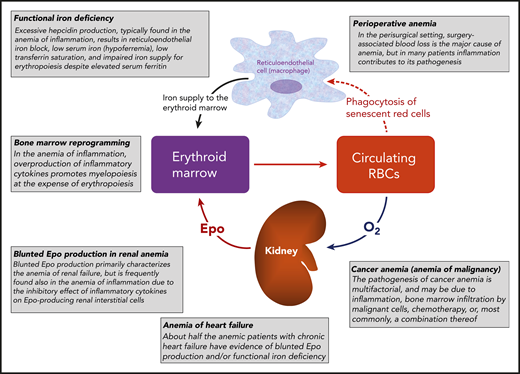 A representation of the human erythron and an illustration of common mechanisms of anemia. This figure is intended to help the reader better understand the treatment of disease-related and perisurgical anemias considered in the “How I Treat” series of this issue of Blood; that is: renal anemia, anemia in heart failure, anemia in cancer, and anemia in the perisurgical setting.