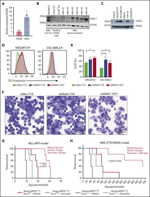 A putative role for SNAI1 in human AML. (A) Quantitative real-time PCR analysis showing SNAI1 mRNA is expressed ∼12-fold higher in human AML patient samples compared with normal hematopoietic stem and progenitor cells (CD34+, n = 3; AML, n = 6; P < .05 Mann-Whitney nonparametric 1-tailed test). SNAI1 expression is normalized to the expression of the housekeeping gene GUSB. (B) SNAI1 protein expression is higher in AML patient samples compared with healthy CD34+ control cells. The MOLM13 cell line is also shown as a comparison. (C) Western blot analysis showing MOLM13-R, OCI-AML3-R, and THP1-R AML cell lines express SNAI1 protein, whereas HL60-R, NB4-R, and Kasumi-R do not. (D) shRNA-mediated SNAI1 knockdown in OCI-AML3-R and MOLM13-R AML cell lines results in upregulation of the myeloid maturation marker CD11b (red and blue lines) compared with the control shRen.713 shRNA (black line). (E) Quantification of the percentage of CD11b+ cells in shRen.713 infected cells (black bars) compared with shSNAI1 infected cells (red bars). Data are represented as mean + standard error of the mean; n = 3 independent replicates. (F) Wright-Giemsa staining analysis of MOLM13-R cells shows evidence of myeloid differentiation, such as increased cytoplasmic/nuclear ratio and presence of cytoplasmic granules, upon SNAI1 knockdown in shSNAI1.774 and shSNAI1.1577 cells compared with control shRen.713 cells. Kaplan-Meier plots showing that Cre (tamoxifen)–mediated loss of Snai1 in MLL-AF9 (G) and AML-ETO/NRAS–driven (H) AML models leads to a significant reduction in the survival of recipient mice as determined by leukemia growth delay (LGD)52 analysis (AML-ETO, P < .05; MLL-AF9, P < .01). Red lines indicate Snai1fl/fl cells, and black lines indicate Snai1+/+ cells. Dotted lines indicate mice treated with tamoxifen vs solid lines indicated mice treated with vehicle. Data are from 5 recipient mice per cohort, each transplanted with 300 000 (MLL-AF9) or 500 000 (AML-ETO/NRAS) AML cells combined from 2 to 3 primary tumors. *P < .05 Student 2-sided unpaired t test, **P < .01 Mantel-Cox test.