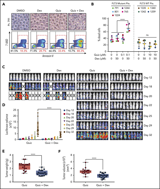 Dexamethasone enhances the antileukemic efficacy of quizartinib in FLT3-mutated AML patient samples ex vivo and AML mouse models in vivo. (A) Representative microscopy images of patient 791 cells treated with DMSO, 100 nM quizartinib, 50 µM dexamethasone, or the combination for 48 hours and corresponding FACS images of cells labeled with APC-Annexin-V and 7-AAD. (B) Quantification of FACS analysis of cell death in 5 FLT3 mutant and 4 wild-type AML patient (Pt) cells treated with the indicated drugs and concentration for 48 hours. (C) In vivo bioluminescence imaging of NSG mice orthotopically xenografted with MOLM13-Luc cells and treated with the indicated drugs or vehicle. Images were obtained at the indicated time points. (D) Bioluminescence quantification of C. Tumor weight (E) and tumor volume (F) of NSG mice subcutaneously xenografted with MOLM13 cells and treated with the indicated drugs for 20 days after 10 days of tumor engraftment.