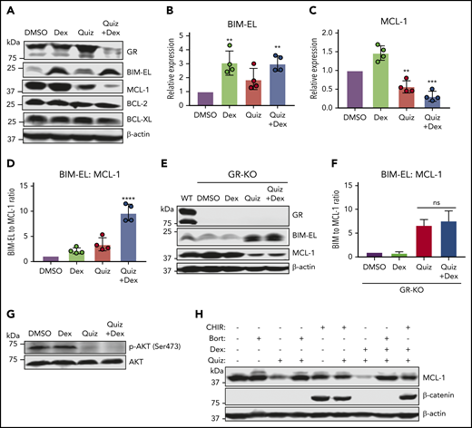 Increased BIM and decreased MCL-1 expression underlies synergistic cell death in FLT3-mutant cells treated with the combination of quizartinib and dexamethasone. A representative immunoblot (A) and quantification of replicate experiments (B-D) (n = 4) showing expression of BCL-2 family proteins following treatment with the indicated drugs (100 nM quizartinib, 50 µM dexamethasone) for 48 hours. Statistical significance is based on comparison of each treatment to DMSO. A representative immunoblot (E) and quantification of replicate experiments (F) (n = 2) showing the ratio of BIM to MCL-1 in GR-knockout MV4-11 cells following treatment with the indicated drugs (100 nM quizartinib and 50 µM dexamethasone) for 48 hours. (G) Immunoblot showing abrogation of phosphorylated AKT in MV4-11 cells after treatment with the indicated drugs (100 nM quizartinib and 50 µM dexamethasone) for 48 hours. (H) A representative immunoblot (n = 2) showing rescue of quizartinib and combination treatment-induced MCL-1 degradation with either bortezomib (Bort) (10 nM) or GSK inhibitor CHIR99021 (CHIR) (10 µM) cotreatment in MV4-11 cells for 18 hours.