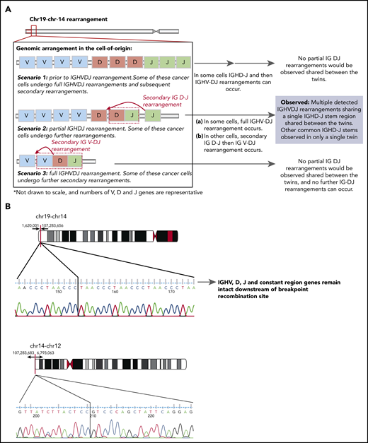 Schematic diagram of the possible IGH locus rearrangements present in the (COO) and the genomic breakpoints of the shared t(14;19) and t(12;14). (A) Scenario of the possible IGH locus rearrangements present in the (COO). Scenario 1 has the COO at the stage prior to IGH VDJ rearrangement. Some of these cancer cells may undergo full IGH VDJ rearrangements and subsequent secondary rearrangements, however these would not be shared between the twins. Scenario 2 has the COO at the stage with a partial IGH DJ rearrangement that is shared between the twins. Some of these cancer cells can undergo further IG V- DJ and/or secondary rearrangements (where a primary immunoglobulin DJ rearrangement can be replaced by an upstream D to downstream J) that may be present only in 1 twin. Scenario 3 has the COO with a full IgH VDJ rearrangement. Some of these cancer cells may undergo further secondary immunoglobulin V rearrangements. Only Scenario 2 is supported by the data. (B) Schematic representation of the genomic breakpoints determined by whole-genome sequencing at the base pair level for t(14;19) and t(12;14).