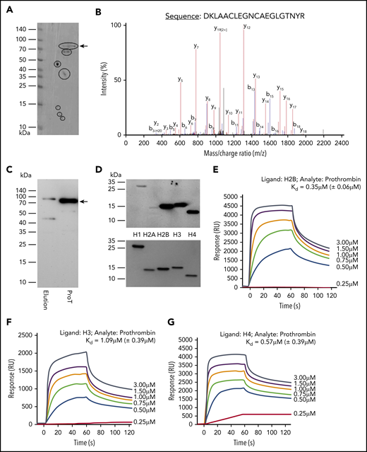 Identification of prothrombin from plasma as a histone-binding protein. (A) Coomassie brilliant blue staining of histone-binding proteins (black circles) captured from plasma by histone-conjugated Sepharose and separated by 2D gel. (B) Typical liquid chromatography-mass spectrometry peaks of a peptide from trypsin-digested spot from 2D gel. (C) Western blotting of isolated histone-binding proteins using antiprothrombin antibody with commercial prothrombin (ProT) as a positive control. Arrow indicates the full length of prothrombin. (D) Gel overlay assay. Equal molar concentrations (2 µmol/L) of recombinant individual human histones were subjected to sodium dodecyl sulfate-polyacrylamide gel electrophoresis and probed with horseradish peroxidase–conjugated prothrombin (upper panel). Lower panel: Coomassie blue–stained gel to demonstrate equal loading of proteins. (E-G) SPR curves for calculating Kd values (mean ± SD) of prothrombin with histone H2B (E), H3 (F), and H4 (G), respectively. Each experiment was repeated 3 times, and a typical experiment is presented. RU, response unit.