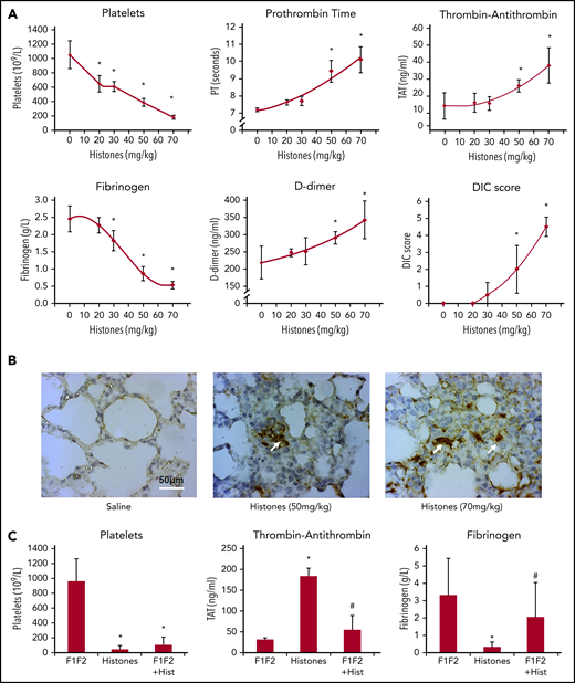 Prothrombin F1 and F2 alleviate histone-induced systemic coagulation activation in vivo. C57BL/6 male mice were anesthetized and infused with different doses of histones through tail veins. One hour after infusion, blood were taken for platelet count, prothrombin time (PT) and concentrations of TAT complexes, fibrinogen, and D-dimer; DIC scores were also calculated (A). (B) Lung sections from histone-infused mice and saline controls were immunohistochemically stained with anti-fibrin antibody, and typical images are presented. Arrows indicate thrombi. Scale bar, 50 μm. (C) Platelet counts (left), TAT (middle), and fibrinogen (right) levels following prothrombin F1 + F2 infusion ± histones. *P < .05 compared to F1/F2 alone; #P < .05 when compared to histones alone (ANOVA).