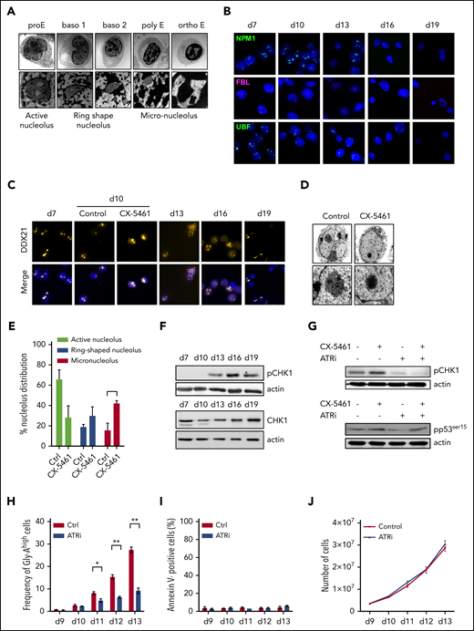 RNA Pol I complex disruption and ATR-CHK1-p53 pathway activation. Human primary erythroblasts were derived from CD34+ progenitors cultured with SCF, IL-6, and IL-3 for 6 days (with the addition of dexamethasone at day 1); SCF and EPO between days 7 and 11; and then EPO alone. (A) TEM analysis of nucleolus structure in human erythroblasts during in vitro differentiation. Original magnification ×4000 (top); ×24 000 (bottom). (B) Representative immunofluorescence images of nucleolar compartments during erythroid differentiation. NPM1, FBL, and UBF were used as markers of the granular component, dense fibrillar component, and fibrillar center, respectively. (C) Representative immunofluorescence images of DDX21 nucleolar delocalization in differentiating erythroblasts, and CX-5461 (50 nM for 48 hours)-treated erythroblasts. (B-C) Micrographs were obtained on a Leica DMI6000 inverted microscope with spinning disk and analyzed with ImageJ. Original magnification ×100. (D) TEM analysis of nucleolus structure in human pro-erythroblasts untreated or treated with CX-5461 (50 nM) for 48 hours. Original magnification ×6000 (top); ×24 000 (bottom). (E) Proportion of active, ring-shaped, and micronucleolar cells in control and CX-5461 treatment conditions. More than 100 nucleoli were analyzed in 3 separate experiments. Mean percentages ± SD. (F) Western blot of phospho-CHK1 serine 345 (pCHK1) and CHK1 during normal erythroid differentiation. (G) The ATR inhibitor (ATRi) VE-821 (1 µM), CX-5461 (50 nM), or both were added to erythroblasts at day 9 for 48 hours. pCHK1 expression by western blot (top) and pp53ser15 expression (bottom). Actin was the loading control. Representative immunoblots of 3 independent experiments. (H) ATRi VE-821 was added to erythroblasts at day 9 for 4 days. GlyA expression was quantified by flow cytometry. Mean percentage ± SEM of 3 experiments. (I) Number of annexin V+ cells. Mean percentage ± SEM of 3 experiments. (J) Proliferation curves. Mean cumulative number of cells ± SEM of 3 experiments.