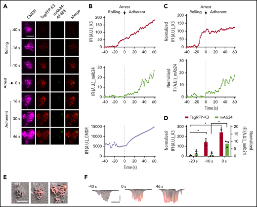 Kindlin-3 recruitment to the plasma membrane precedes integrin high affinity during arrest. (A) K3KO HL-60 cells expressing TagRFP-K3 were labeled with the membrane dye CMDR and rolled at 6 dyn/cm2 on coverslips coated with 5 μg/mL P-selectin-Fc and 10 μg/mL ICAM-1-Fc. Then, 100 ng/mL IL-8 was perfused in the presence of 1 μg/mL mAb24-Alexa Fluor 488 (mAb24-AF488). The cell rolling and arrest were observed using qDF imaging. Flow direction was from top to bottom. Merged images show mAb24-AF488 (green) and TagRFP-K3 (red). Scale bar, 5 μm. (B) Integrated fluorescence intensity (IFI, mean fluorescence intensity × area) of kindlin-3 and mAb24-AF488 antibody labeling is depicted as a function of time before and after arrest at 0 seconds. (C) IFI signal after normalization to the membrane (IFI_K3 or mAb24/IFI_CMDR×10 000). (D) Quantification of TagRFP-K3 and mAb24-AF488 binding during cell rolling and arrest in 3 independent experiments. (E-F) 3D distributions and dynamics of high-affinity β2 and kindlin-3 clusters in neutrophils. Membrane signals were converted to hills (microvilli) and valleys (space between microvilli). Top (E) and side (F) views of the 3D topography of membrane (gray) were overlaid with kindlin-3 (red) and mAb24 (green) clusters. Yellow, colocalization. (F) Horizontal bar represents 5 μm; vertical bar, 100 nm. *P < .05.