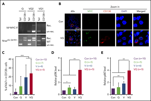 Molecular characterization of VQ myeloma cells. (A) Genotyping of NrasQ61R/+ and Vκ*MYC alleles to assess recombination efficiencies in VQ CD138+ cells. (B) hMYC expression in primary CD138+ plasma cells was detected using confocal immunofluorescence. Scale bar, 20 μm. The areas within the red rectangles were magnified (×5); original magnification ×60. (C) Quantification of Ki67+ cells in primary CD138+ cells from moribund VQ MM mice and age-matched control IgG1-Cre, V, and Q mice. (D-E) Quantification of phosphorylated ERK (pERK) (D) and pAKT levels (E) in primary CD138+ cells from moribund VQ MM mice and age-matched control IgG1-Cre, V, and Q mice. *P < .05; **P < .01; ***P < .001. DAPI, 4′,6-diamidino-2-phenylindole; Rec., recombined; un-rec., unrecombined.